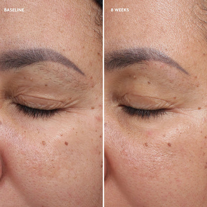 Total Eye Firm & Repair Cream