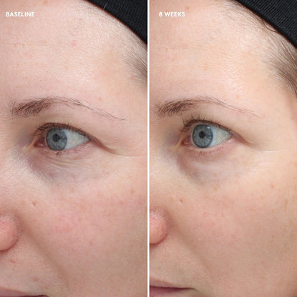 Total Eye Firm & Repair Cream
